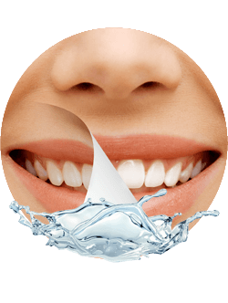 Praxisklinik Bartsch - Weiße Zähne dank Bleaching